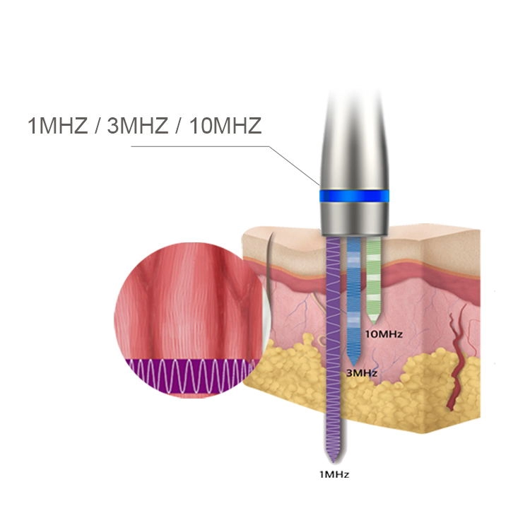 อัลตราซาวนด์ LDM Noblesse 10MHz Therapy 3 in 1 Ultrasonic Sin Wrinkle Remove Beauty Machine อุปกรณ์ดูแลผิวหน้าด้วยคลื่นอัลตราซาวนด์ความถี่สูง