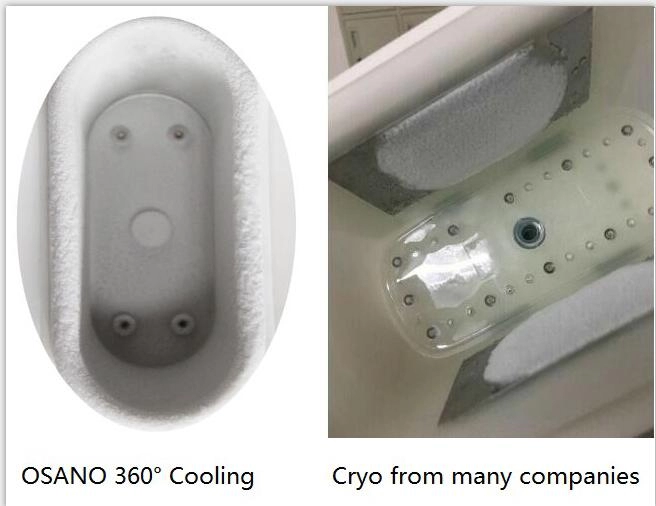 แบบพกพา Dual Handle Cryo 360 °ลดน้ำหนัก Slimming Cryotherapy Machine อุปกรณ์ความงาม